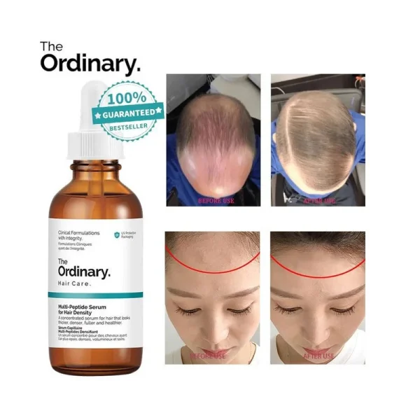 The Ordinary Sérum Multi Peptidique pour la Densité des Cheveux