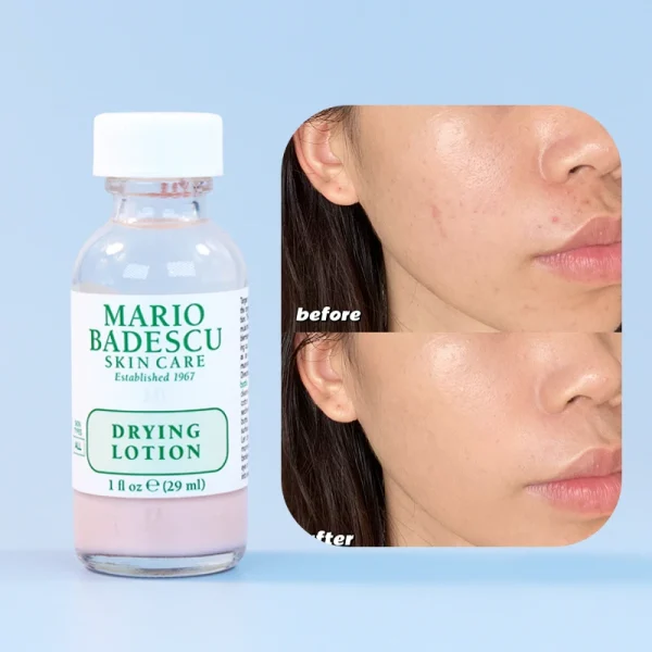 MARIO BADESCU Drying Lotion Asséchante Anti-Imperfections