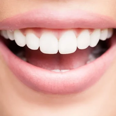 CREST : Un soin dentaire optimal pour un sourire éclatant