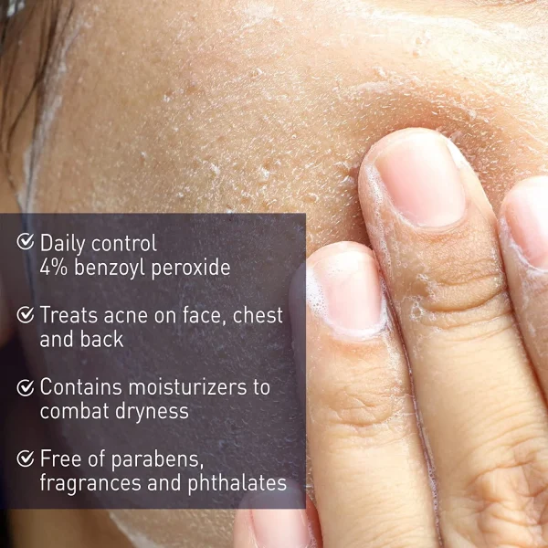 PANOXYL – Nettoyant Crémeux Contre l’Acné 4% Peroxyde de Benzoyle Contrôle Quotidien 7