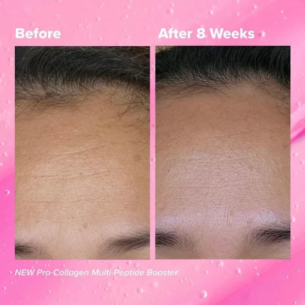 PAULA’S CHOICE – Pro-Collagen Multi-Peptide Booster – Sérum 6X Peptide Complex 20ml
