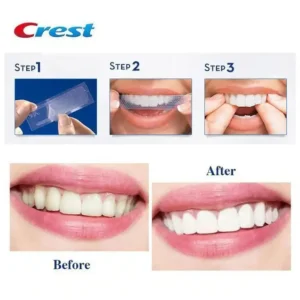 CREST - 3D Whitestrips Monthly Brightener Kit de Blanchiment Dentaire (20 Bandes)